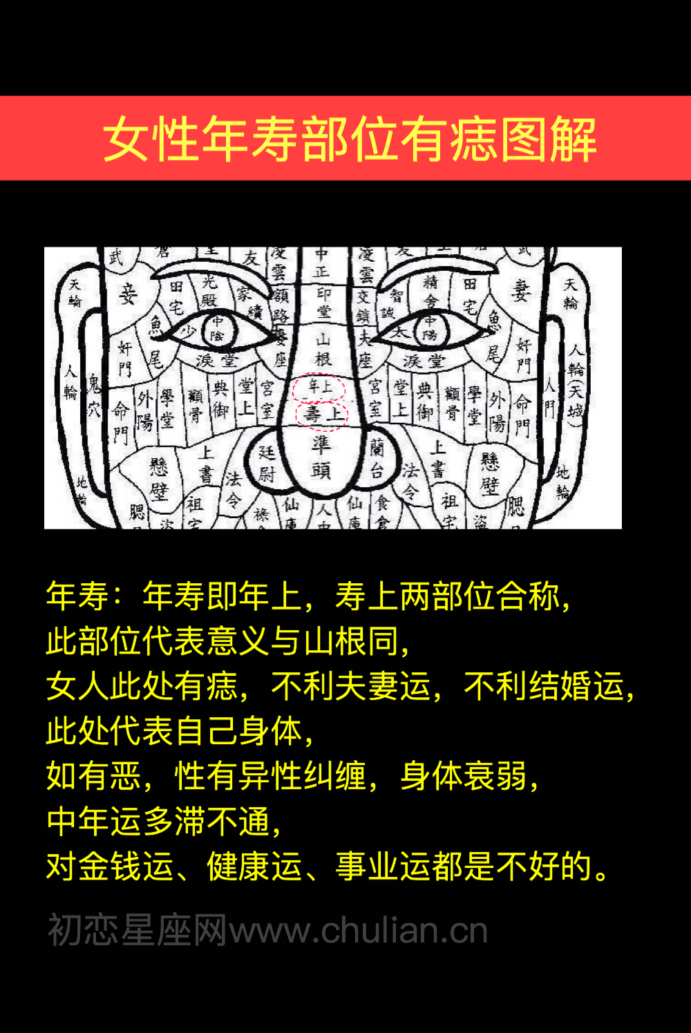 女性年壽部位有痣圖解