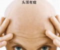 男人的福痣和禍痣